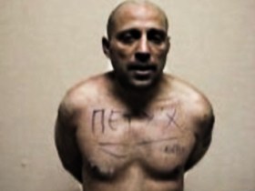 Жертва пытки. Фото с сайта Союза заключенных