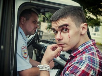 Избитый полицейским Александр Зыков. Фото: 7x7-journal.ru