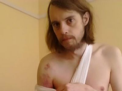 Александр Зинов со сломанной рукой на акции 5 мая в Калуге. Фото: ovdinfo.org